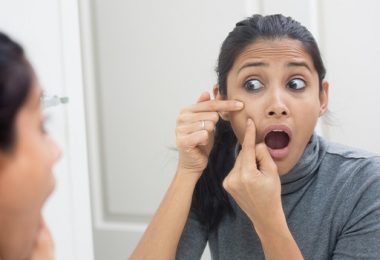 Diverse Opties voor het Verwijderen van Acne Littekens