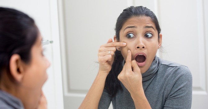 Diverse Opties voor het Verwijderen van Acne Littekens