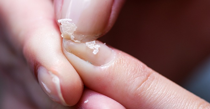 Heb je last van Broze en Gescheurde Nagels? Lees Verder!