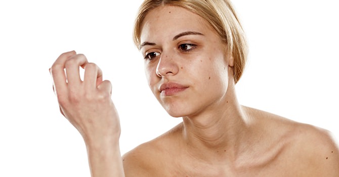 Je Nagels Beschermen tegen Afwijkingen