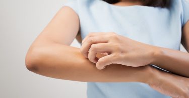 Jeuken Je Handen om Meer te Weten Over Seborroisch Eczeem?