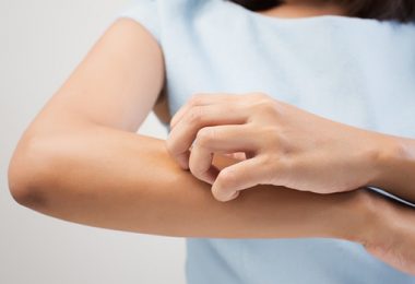 Jeuken Je Handen om Meer te Weten Over Seborroisch Eczeem?