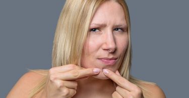 Meer Te Weten Komen over de Oorzaken van Acne