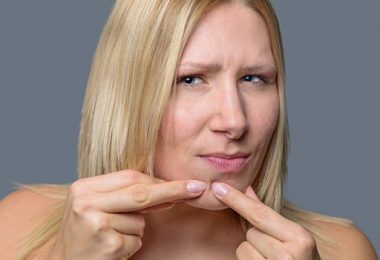 Meer Te Weten Komen over de Oorzaken van Acne