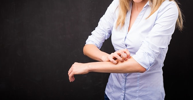 Met Psoriasis Omgaan, Leer Hier Hoe!
