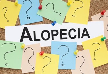 Onderzoek Geeft Hoop voor Mensen met Alopecia Areata