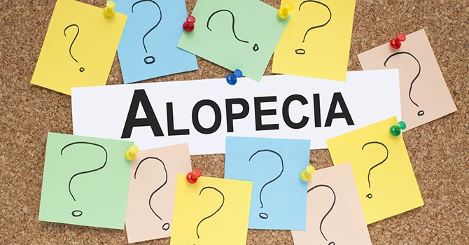 Onderzoek Geeft Hoop voor Mensen met Alopecia Areata