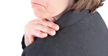 Snel Haarproblemen Oplossen, Lees Snel Hoe!