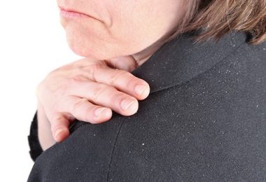 Snel Haarproblemen Oplossen, Lees Snel Hoe!