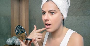 Stop de Verspreiding van Acne en van de Geruchten over Acne