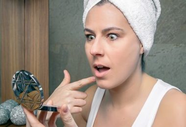Stop de Verspreiding van Acne en van de Geruchten over Acne