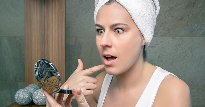 Stop de Verspreiding van Acne en van de Geruchten over Acne