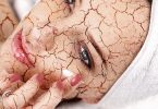 Top 3 Tips voor Verlichting van de Droge Huid