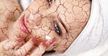 Top 3 Tips voor Verlichting van de Droge Huid