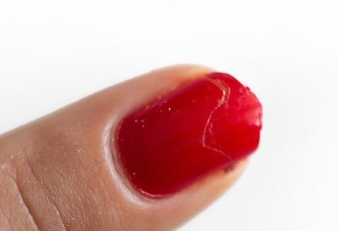 Vermijd de Pijn van Nijnagels met Marokkaanse Arganolie