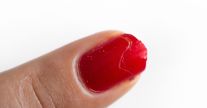 Vermijd de Pijn van Nijnagels met Marokkaanse Arganolie
