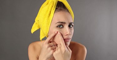 Voorkom Acne met Basis Huidverzorging!