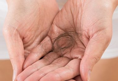 Oplossingen Voor Haarverlies: Wat Zijn Je Opties?